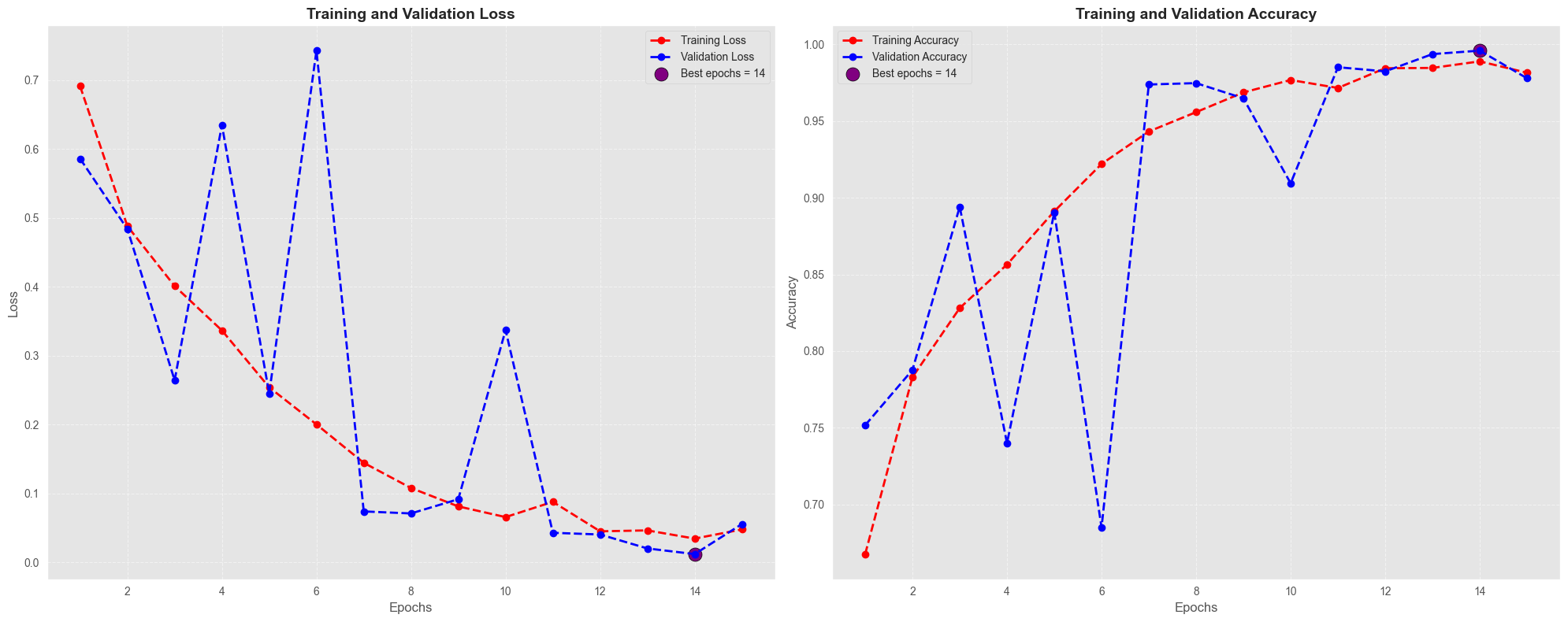 Cardiomegaly Detection (DenseNet-169) — Dense Connectivity History