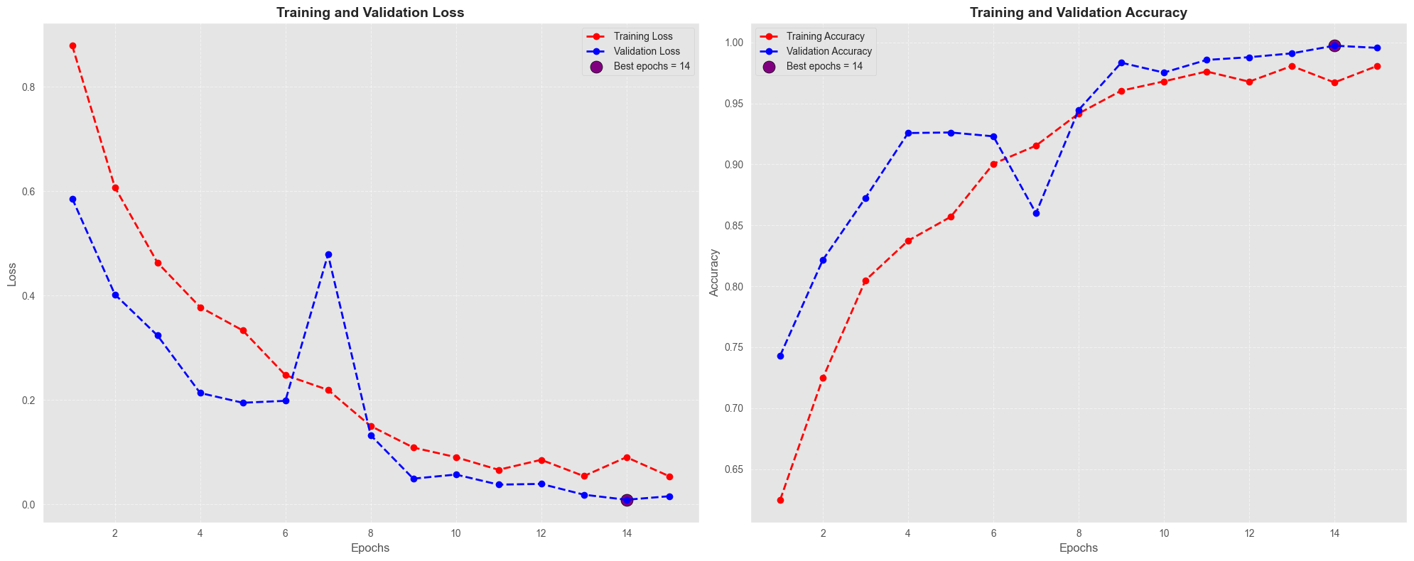 Cardiomegaly Detection (Inception-V3) — Multi-Scale Training History