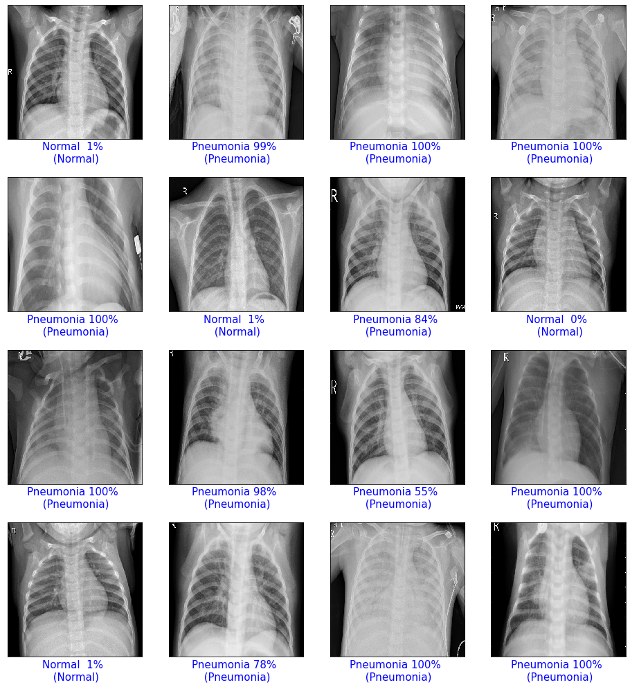 X-Ray Pneumonia Detection — Prediction Distribution